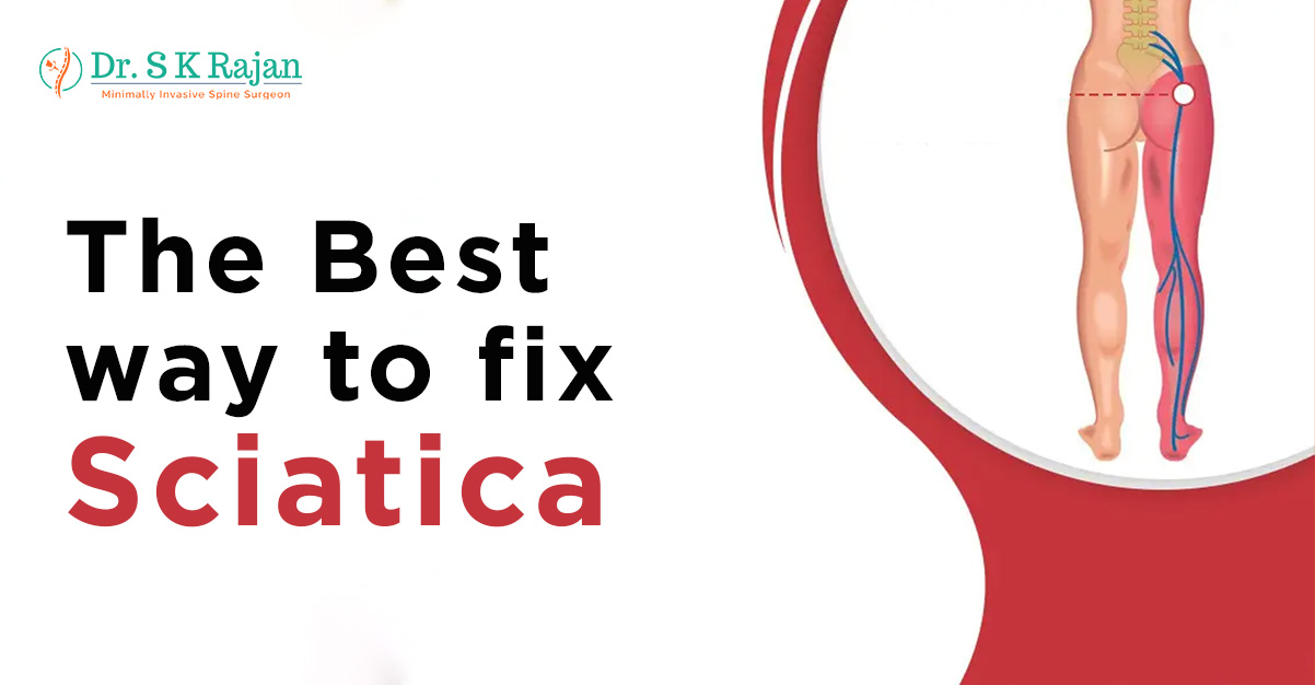 What is the best way to fix sciatica